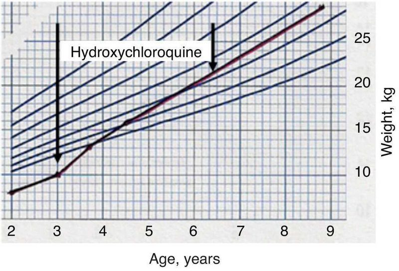 Propranolol used