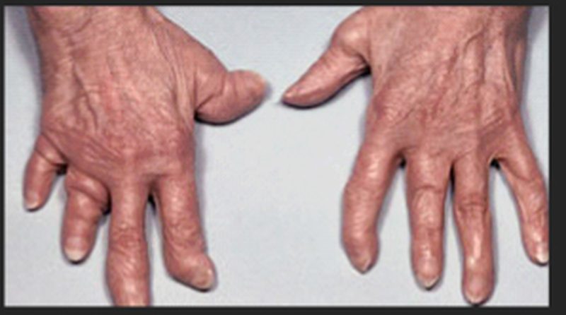 Where can i buy propranolol hydrochloride