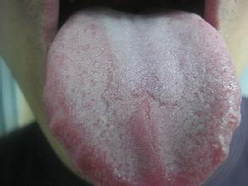 Lasix dose for chf